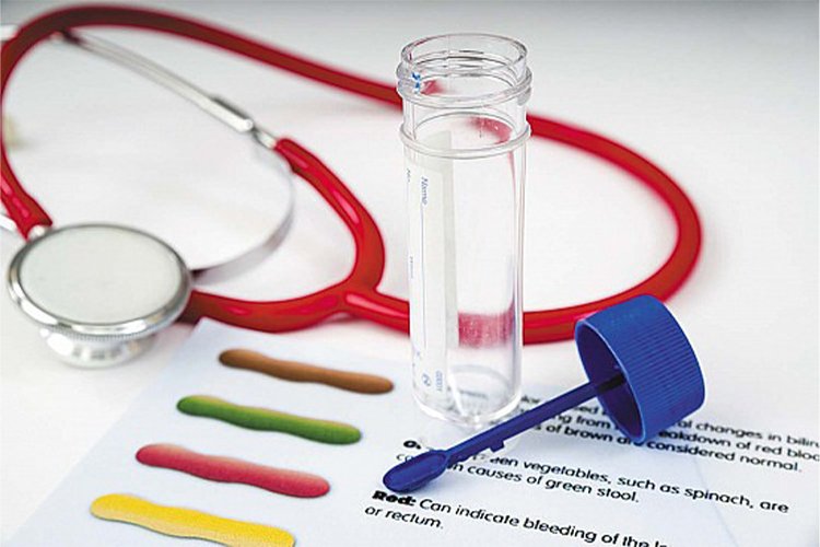 New urine test may help some men with elevated PSA avoid a biopsy